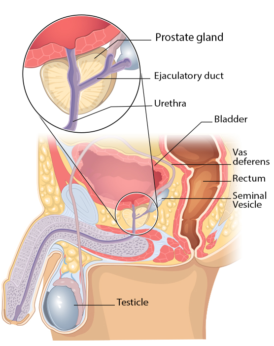 prostate treatment in indore